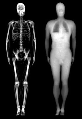 CCNY’s Nir Krakauer finds link between trunk fat-free mass and increased mortality in adults