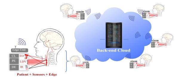 Conceptual diagram of five edge units sending data to central cloud unit
