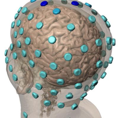 Marom Bikson Brain Stimulation Research