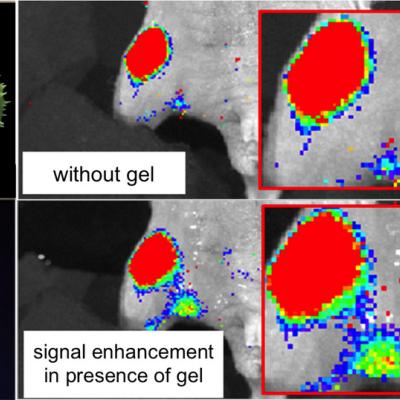 George John cancer_Imaging